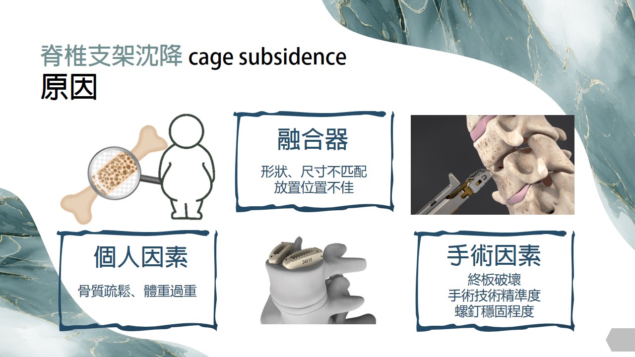支架沉降原因示意圖