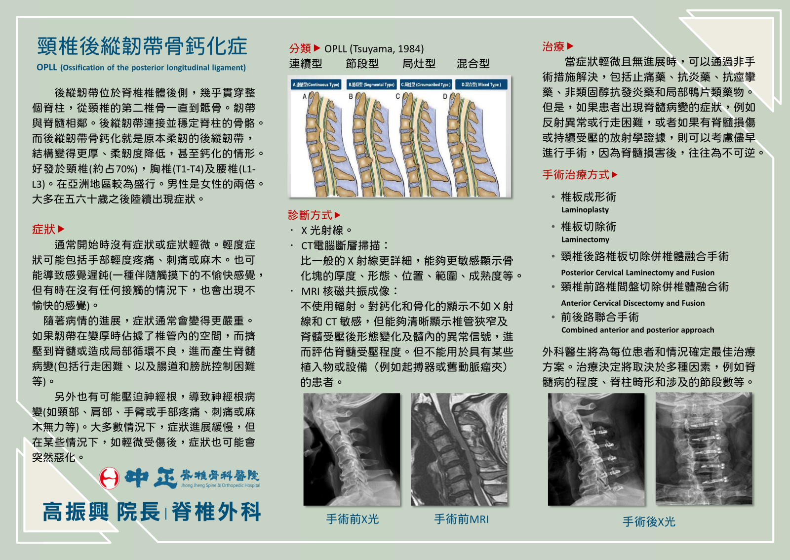 頸椎後縱韌帶骨鈣化症