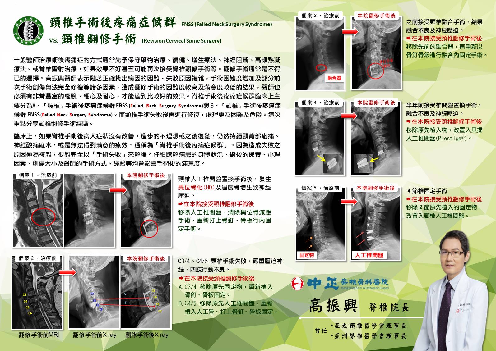 頸椎手術影像 1