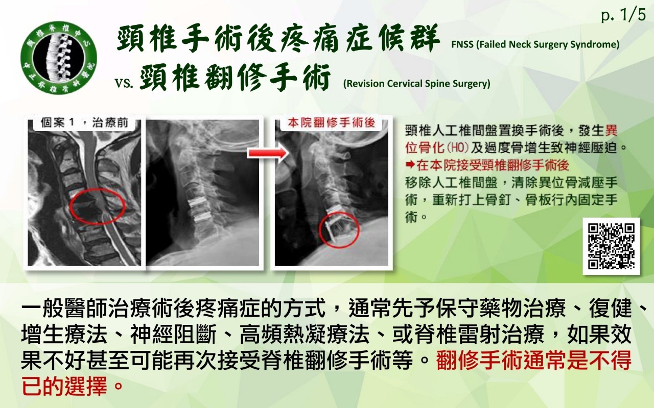 頸椎手術影像 104
