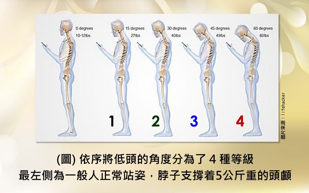 頸椎手術影像 90