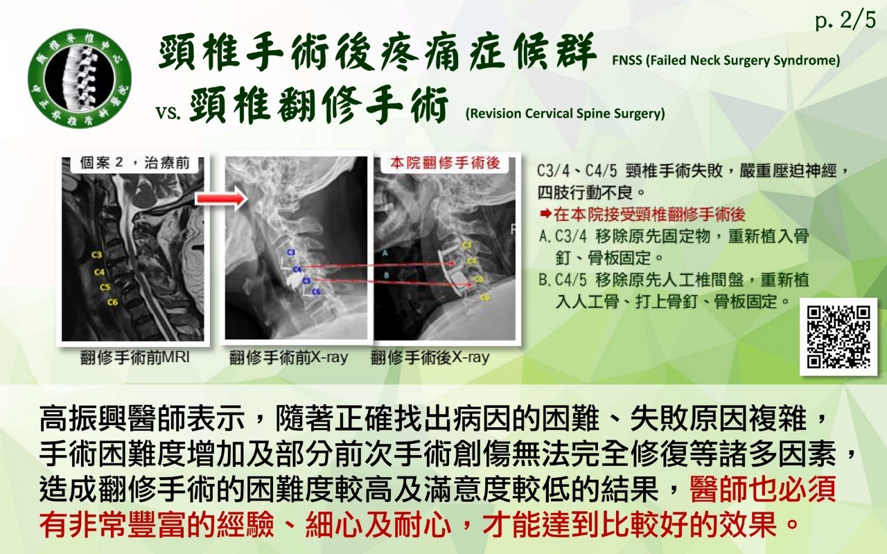 頸椎手術影像 105