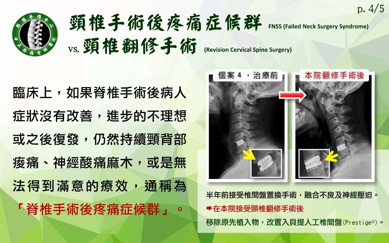 頸椎手術影像 107