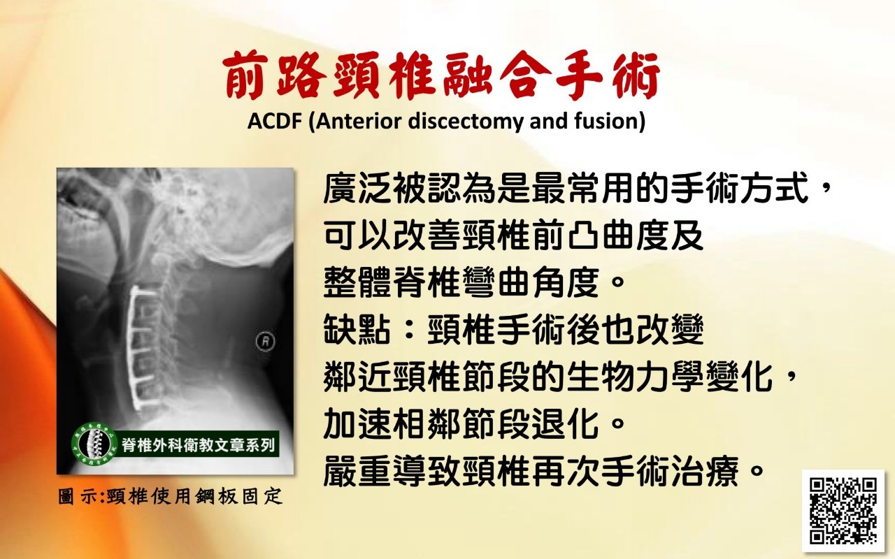 頸椎手術影像 73