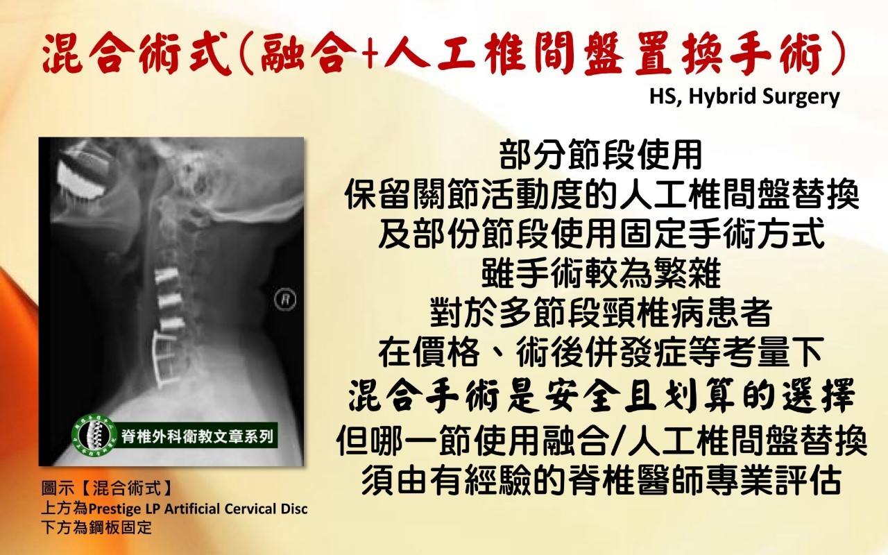 頸椎手術影像 75