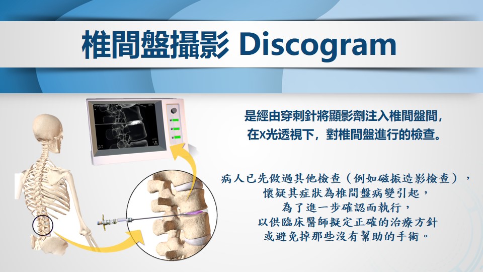 椎間盤攝影術影像