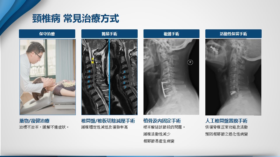 頸椎示意圖 2