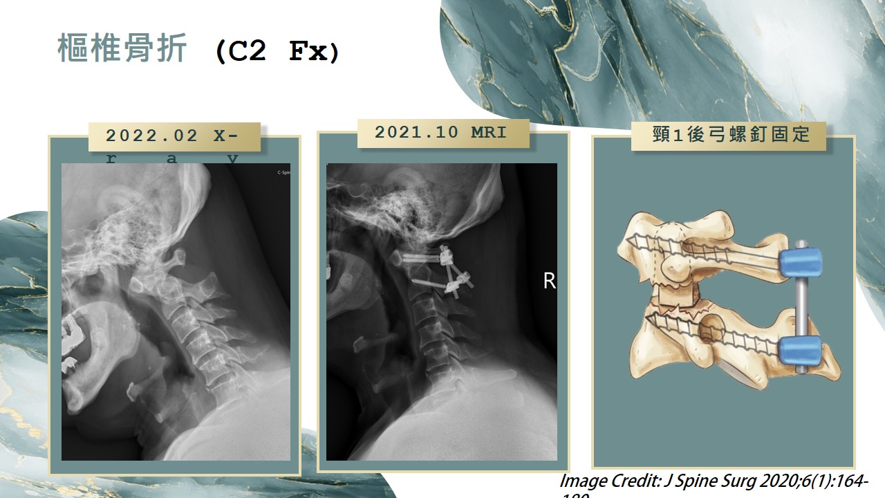 病例分享影像 07
