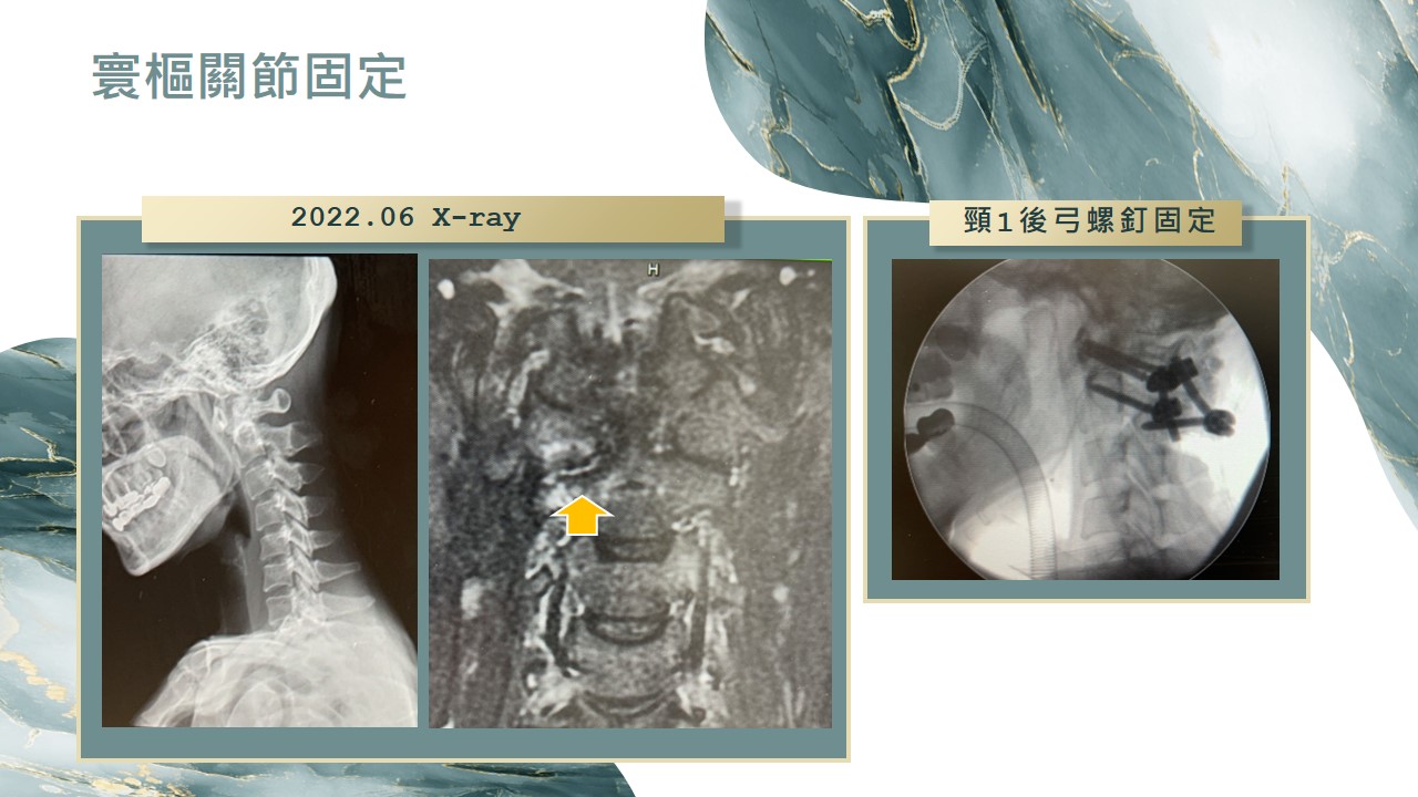 病例分享影像 08