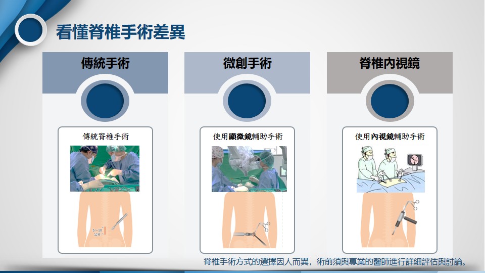顯微手術示意圖