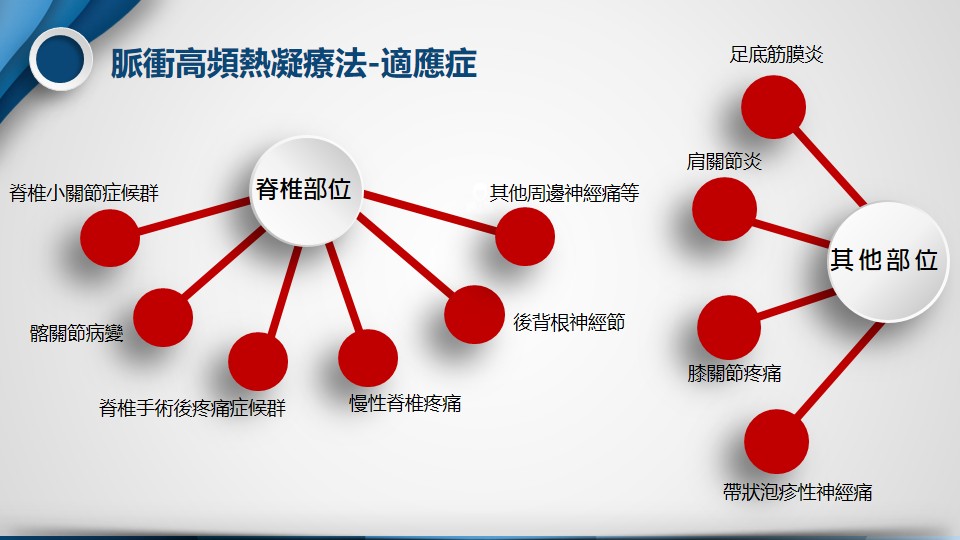 高頻熱凝療法示意圖3