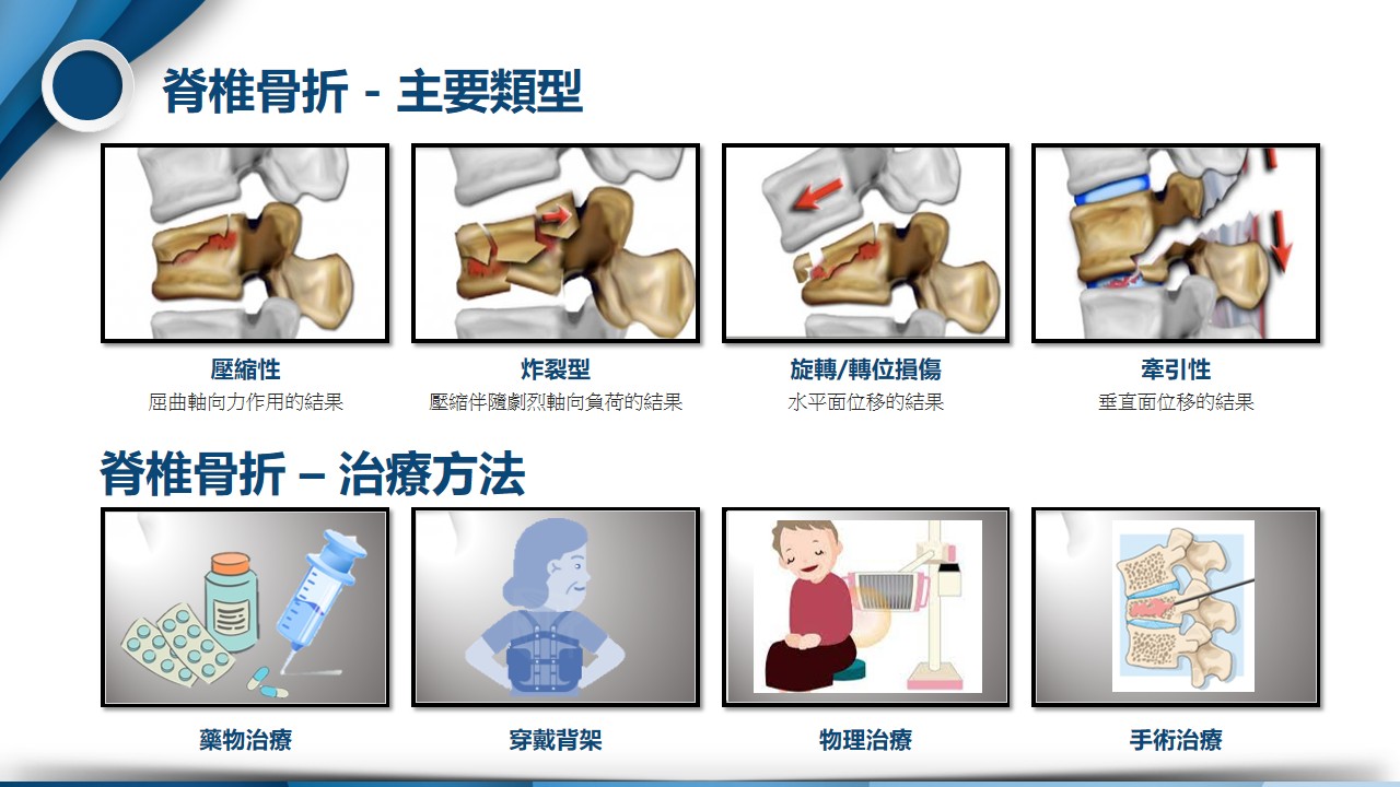 X光檢查示意圖
