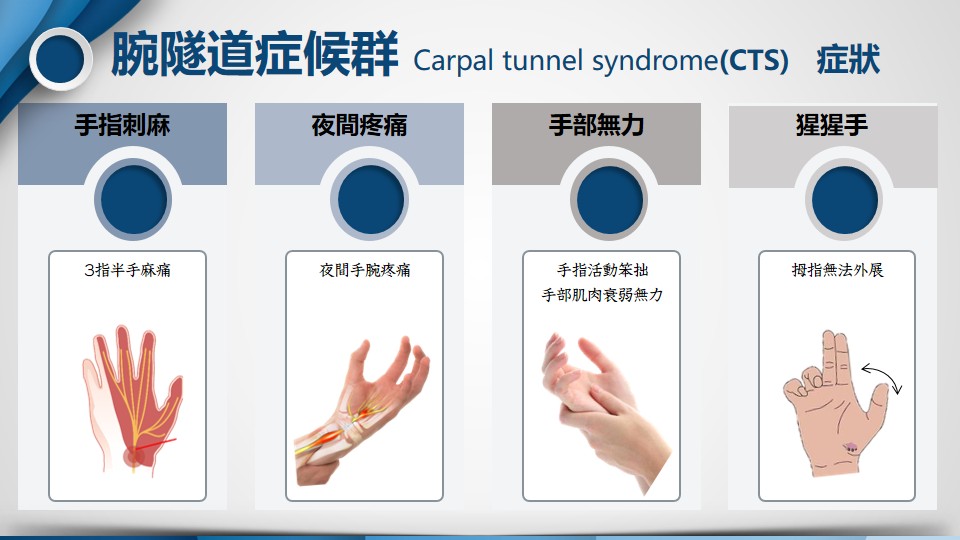 腕隧道症候群示意圖2