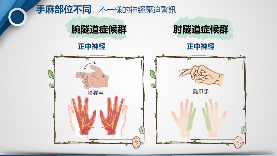 肘隧道症候群影像3